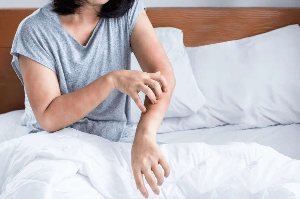 cimici da letto disinfestazione